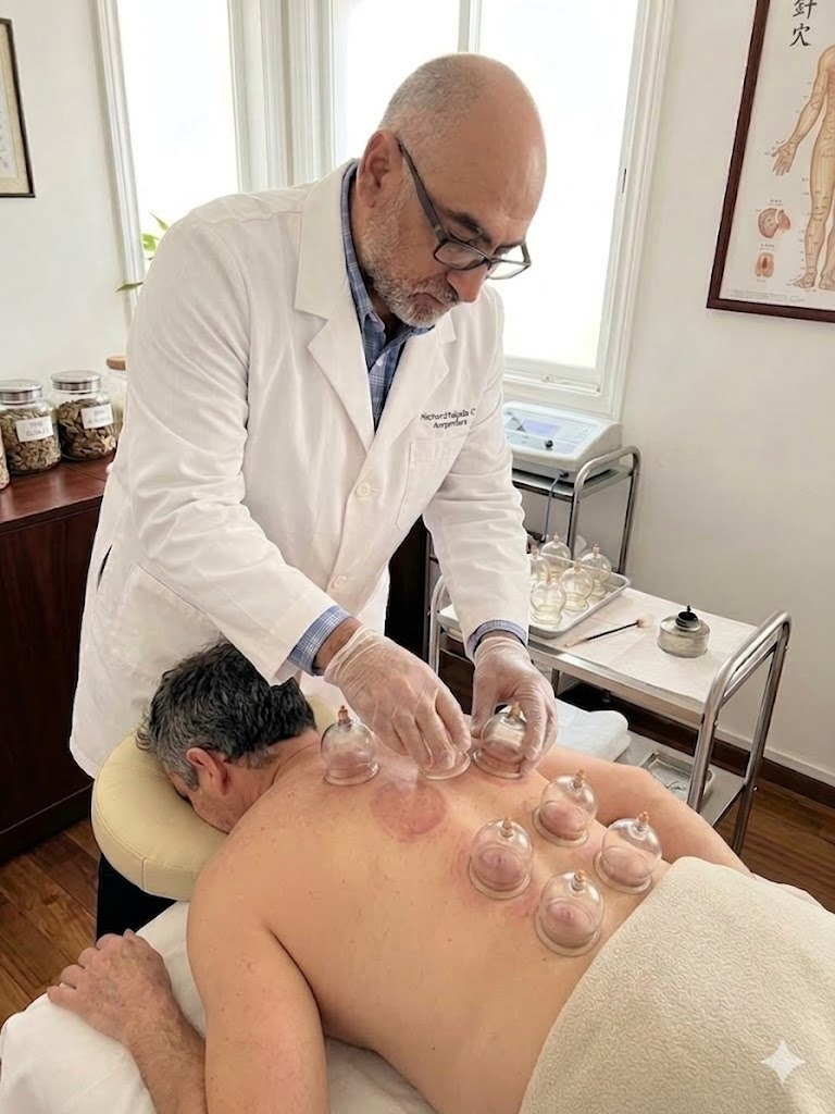 Terapia con ventosas